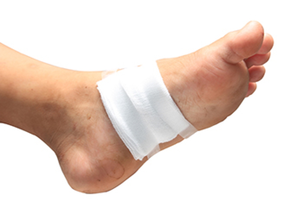 Diabetic Foot Ulcers and Proper Wound Care
