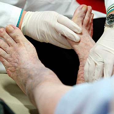 Wound Care