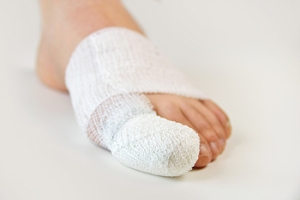 Have I Broken My Toe?