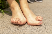 How Rheumatoid Arthritis Affects the Feet and Ankles