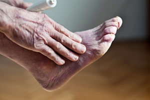 Navigating Poor Foot Circulation and Mobility