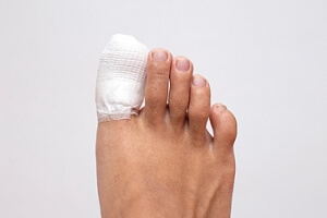 What Should I Do if I Broke My Toe?